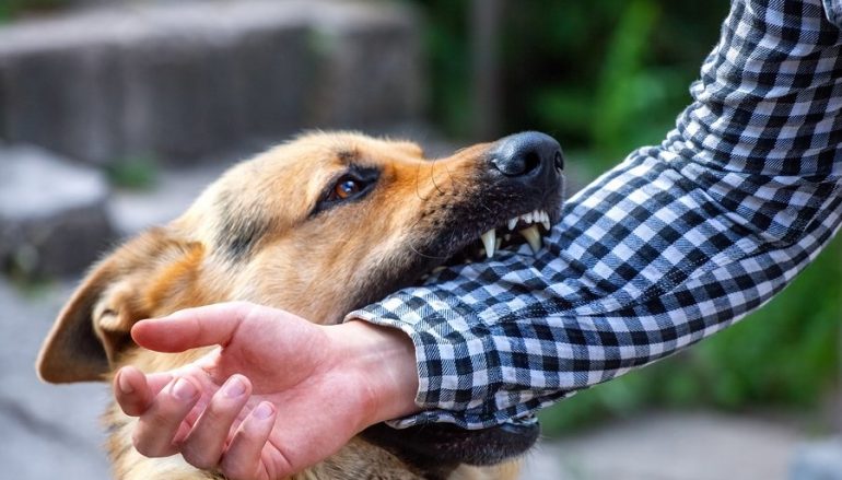 Laws Related to Dog Bites That You Should Know