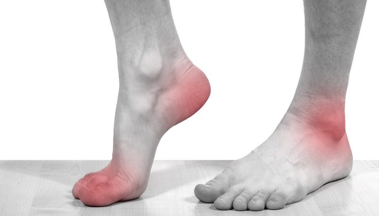 Managing Foot Pain and Mobility During the Healing Process
