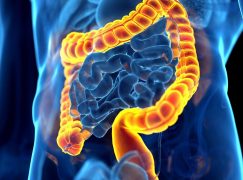 Gastroenterologists and Colon Cancer: The Crucial Connection